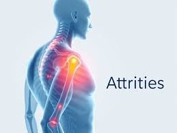 attrities